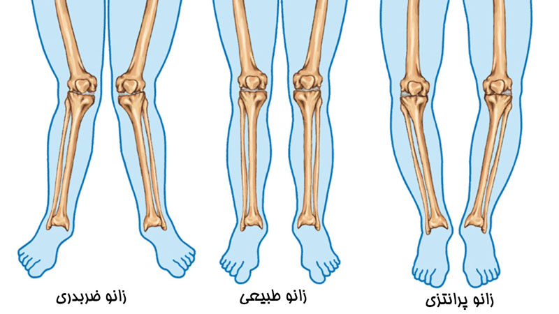 braced knee crossed knee