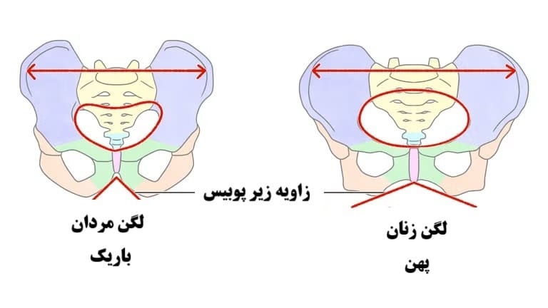 کف لگن و دویدن؛ همه‌چیز درباره یک دردسر پنهان